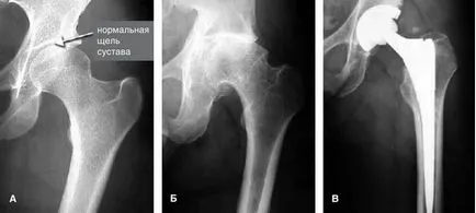 hip MRI, amely megmutatja, hogyan kell csinálni irodalom