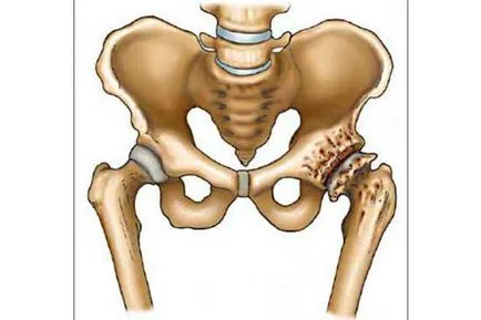 hip MRI, amely megmutatja magatartás