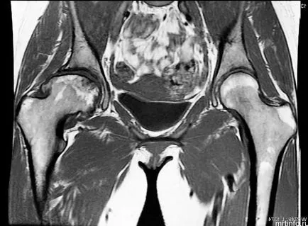 hip MRI, amely megmutatja, hogyan kell csinálni irodalom