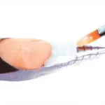 Nail Kabát keresztül gél és akril (gél) Nail Kabát keresztül gél és akril