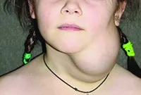 Azon bőrnövedékeket