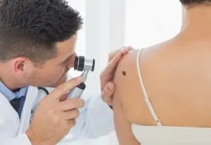 Növekedés a bőrön formájában egy fotó szemölcsök, hogyan kell meghatározni, hogy mi ez - a kukorica, vagy szubkután akne (pattanások hasonló szemölcs) Növekedés a bőrön formájában egy fotó szemölcsök, hogyan kell meghatározni, hogy mi ez - kukorica, pattanások vagy szubkután
