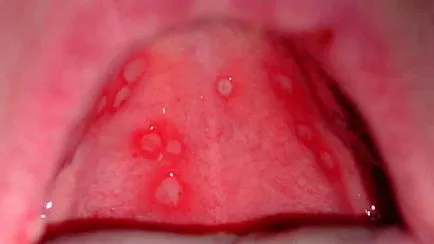 A nyelv, hogyan kell kezelni fájó, fényképe és neve