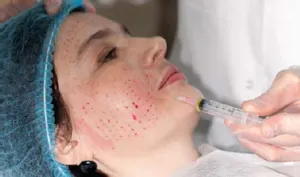 Nagyon nagy pórusok az arcodon - hogyan kell tisztítani, és megszabadulni a maszk kezelésére