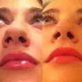 Működés rhinoseptoplasty árak orr, fotók, videók, vélemények (orr) Működés rhinoseptoplasty orr árak, fotók, videók, vélemények
