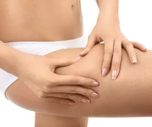 Abból, amit cellulit létre az oka a betegség - nem narancsbőr! (Miért cellulit) Abból, amit cellulit létre az oka a betegség - nem narancsbőr!