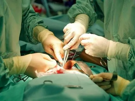 Adj mindent Vengriyane legyenek donorok alapértelmezés szervek - Mednova