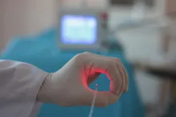 A placenta-polip okai, tünetei és kezelése (a betegség a méh) A placenta polip okai, tünetei és kezelése