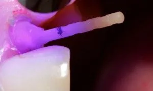 A pecsét a csap, mint nem, tettem a pin fáj