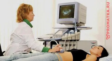 A placenta polip - tünetek, okok, kezelés