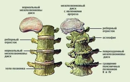 Kezelés előnyeit a gerinc sérv magánklinikák