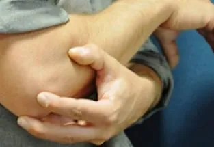 Akne hasonló miért harap meg, és hogyan kell gyógyítani őket