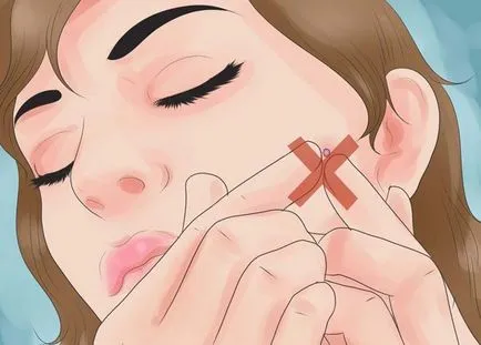Pattanások menstruáció előtt okainak, megelőzésének tanácsadás (tanácsok) Pattanások menstruáció előtt okainak, megelőzésének tippek