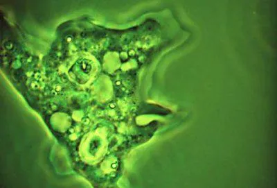 Protivoprotozoynoe jelent - mi haszna a hatásmechanizmus és protozoaellenes szerek