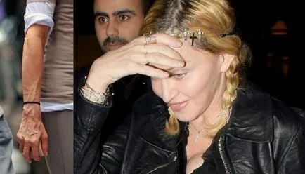 A titok szépség és fiatalság Madonna - eljárást redermalization!