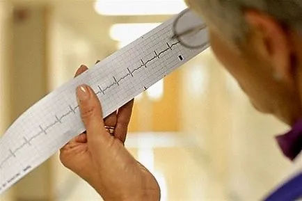 Sinus arrhythmia a szív - a veszélyesebb ez, kezelés, gyógyszerek, kardiózzon ellátás (szív) Sinus arrhythmia a szív - a veszélyesebb ez, kezelés, gyógyszerek, kardiózzon ellátás