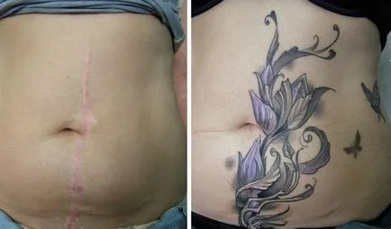 Tattoo gyomra a nők szülés után, hogy elrejtse a striák