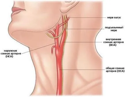 Trifurcation az arteria carotis interna