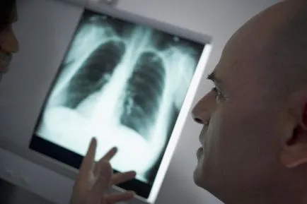 Légzési elégtelenség tünetei, okai fellépés (tachycardia) Légszomj tünetek, okok, akciók