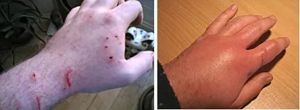 A harapás egy macska - ez veszélyes-e vagy sem, és az első támogatás a harapás (cat) A harapás egy macska - ez veszélyes-e vagy sem, és elsősegélyt falatok
