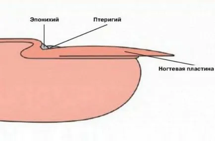 Erősítése gél körömlakk és a gél bevonat