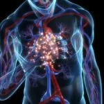 Érgörcsös angina okai, tünetei és kezelése (ok) Vasospasticus angina okai, tünetei és kezelése