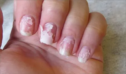 Helyreállítás a köröm építeni recepteket és tippeket (köröm) Recovery Nails felépítése után recepteket és tippeket