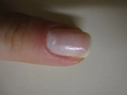 Mágikus eszköz eltávolítása a kutikula szegély - Orly - cutique - kutikula - a folttisztító
