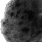 Glandular mell - rostos és cisztás