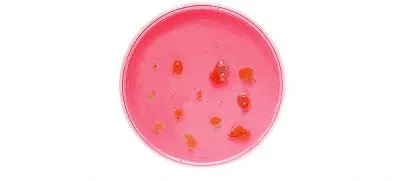 Vulvovaginalis candidiasis meg