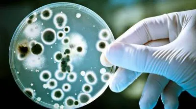 Vulvovaginalis candidiasis meg