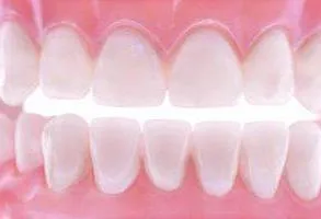 Műfogsorok puha vélemény szakemberek fotók (lágy) Műfogsorok puha vélemény szakemberek fotók