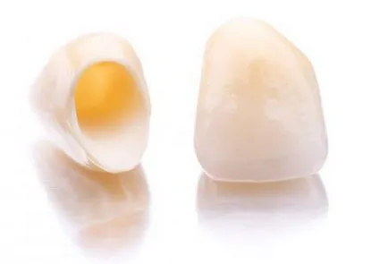 Fogak kerámia leírás, jellemzők, gyártási és vélemények
