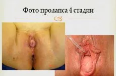 Anovulációja mi ez