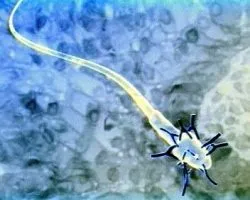Antisperm elemzés