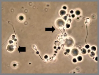 Antisperm elemzés Antisperm elemzés