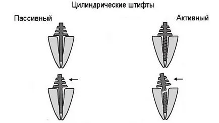 Mi egy horgony pin