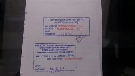 HCV vérvizsgálat, mi ez HCV vérvizsgálat, mi ez