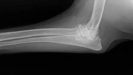 Mi arthritis kutyák Mi arthritis kutyák