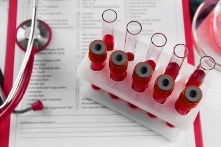 HCV vérvizsgálat, mi ez HCV vérvizsgálat, mi ez