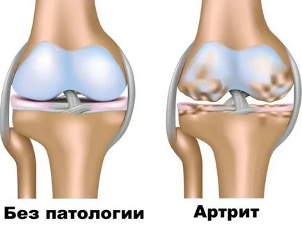Mi arthritis kutyák Mi arthritis kutyák