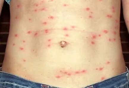 Ne vegye allergiásak a hadsereg Ne vegye allergiásak a hadsereg