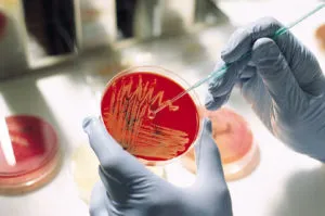 Mi a gonorrhea betegség Mi a gonorrhea betegség
