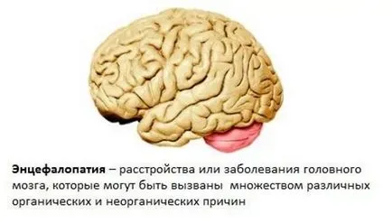 agy encephalopathia kezelésére