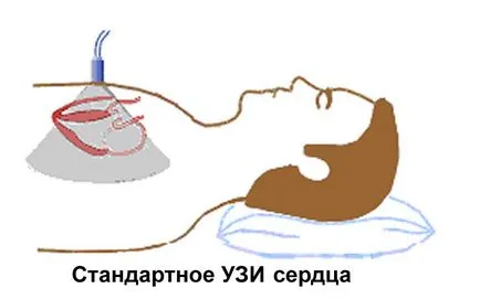 Mi echokardiogramot