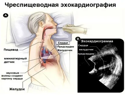 Mi echokardiogramot
