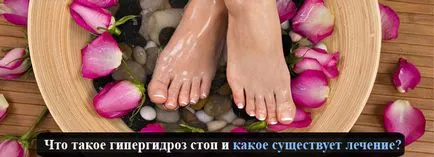 Hyperhydrosis megállítani