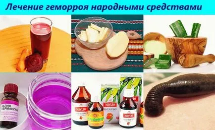 Hogyan kell kezelni aranyér férfiak