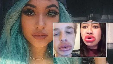 Lips, mint egy kacsa Lips, mint egy kacsa