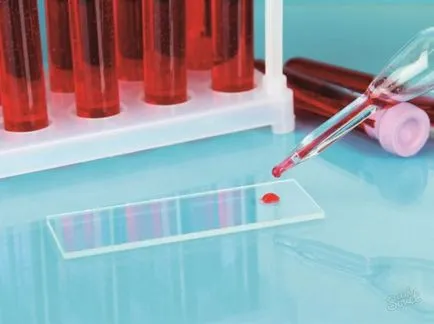 HCV vérvizsgálat, mi ez HCV vérvizsgálat, mi ez